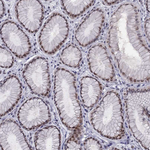 RPRD2 Antibody in Immunohistochemistry (Paraffin) (IHC (P))