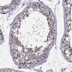 RPRD2 Antibody in Immunohistochemistry (Paraffin) (IHC (P))