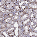 RPRD2 Antibody in Immunohistochemistry (Paraffin) (IHC (P))