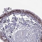 RPRD2 Antibody in Immunohistochemistry (IHC)