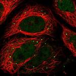 RPRD2 Polyclonal Antibody