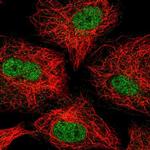 ZNF618 Polyclonal Antibody