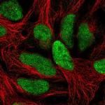 CA052 Polyclonal Antibody