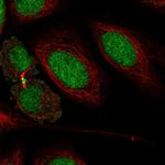 KIAA1143 Polyclonal Antibody