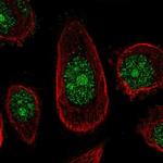 ZNF16 Polyclonal Antibody