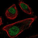 PRPF31 Antibody in Immunocytochemistry (ICC/IF)