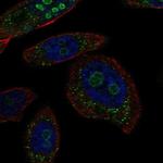 BRINP2 Polyclonal Antibody