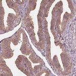 RPS5 Polyclonal Antibody