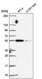 SRP54 Antibody in Western Blot (WB)