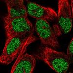 TNRC6C Polyclonal Antibody