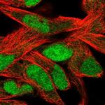 SLFN11 Polyclonal Antibody