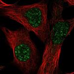 TMEM179B Polyclonal Antibody