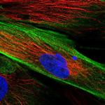FAM167B Polyclonal Antibody