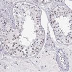 TEPP Antibody in Immunohistochemistry (IHC)