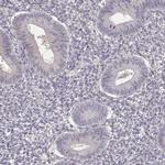 TEPP Antibody in Immunohistochemistry (IHC)