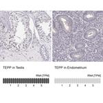 TEPP Antibody