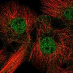 FAM84B Polyclonal Antibody