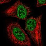 CDKN2AIP Polyclonal Antibody