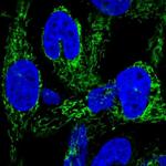 HEATR6 Antibody in Immunocytochemistry (ICC/IF)