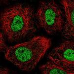 TGIF Polyclonal Antibody