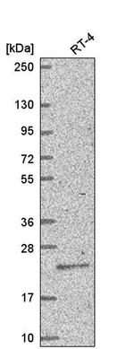 TGIF Antibody in Western Blot (WB)