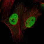 CTDSPL2 Antibody in Immunocytochemistry (ICC/IF)