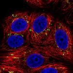 SLC35E1 Polyclonal Antibody