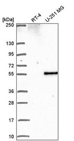 PIP4K2B Antibody in Western Blot (WB)