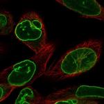 Lamin B Receptor Polyclonal Antibody