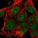 FAM222B Polyclonal Antibody