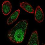 FBXO27 Antibody in Immunocytochemistry (ICC/IF)