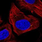 DMRTA1 Polyclonal Antibody