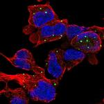 ZC3H10 Polyclonal Antibody