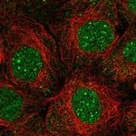 TMEM62 Polyclonal Antibody