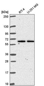 TMEM62 Antibody in Western Blot (WB)