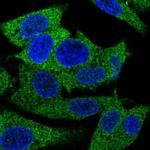 PRPSAP1 Polyclonal Antibody