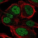 ZNF561 Polyclonal Antibody