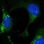 FBXO21 Polyclonal Antibody