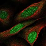 CCDC3 Polyclonal Antibody