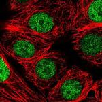 NCBP2 Polyclonal Antibody