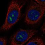 MPPED2 Polyclonal Antibody