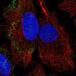 PARVB Polyclonal Antibody
