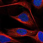 FAM116A Antibody in Immunocytochemistry (ICC/IF)