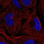 ZNF616 Polyclonal Antibody