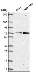 ZNF616 Antibody in Western Blot (WB)
