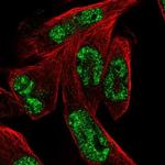 MSANTD3 Polyclonal Antibody