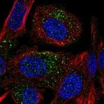 TMEM8B Polyclonal Antibody