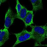 RKHD4 Polyclonal Antibody