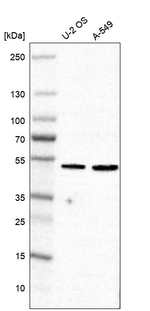 RKHD4 Antibody in Western Blot (WB)