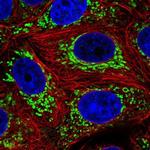 DNLZ Polyclonal Antibody